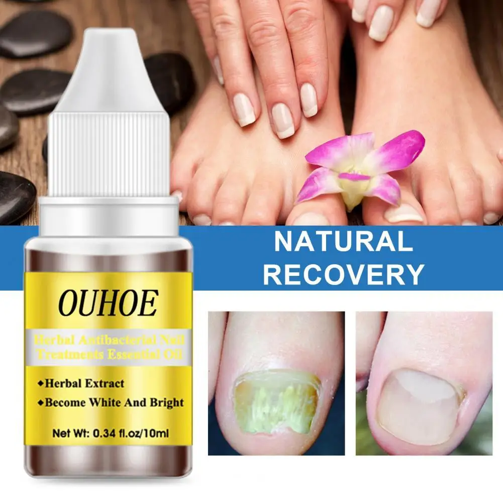 OUHOE 10ml Nail Treatment Liquid Mini Effective Herbal Extracts Fungal Nail Treatment Liquid for Household
OUHOE 10ml Nail Treatment Liquid Mini Effective Herbal Extracts Fungal Nail Treatment Liquid for Household