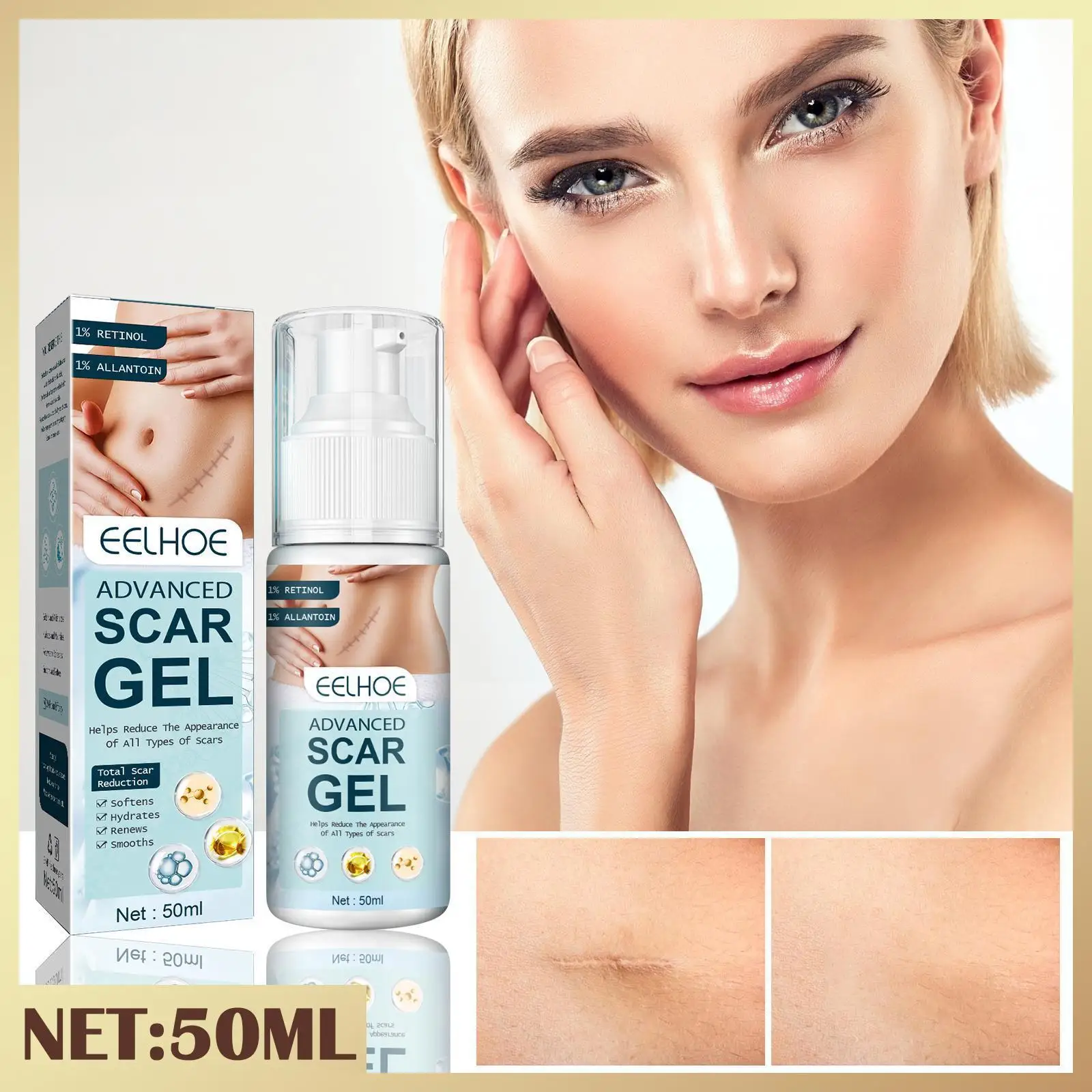 50ml Scar Gel Scar Repair Cream Acne Scar Removal Remove Whitening Stretch Care Smooth Skin Pigmentation Corrector Marks A9T7
50ml Scar Gel Scar Repair Cream Acne Scar Removal Remove Whitening Stretch Care Smooth Skin Pigmentation Corrector Marks A9T7
