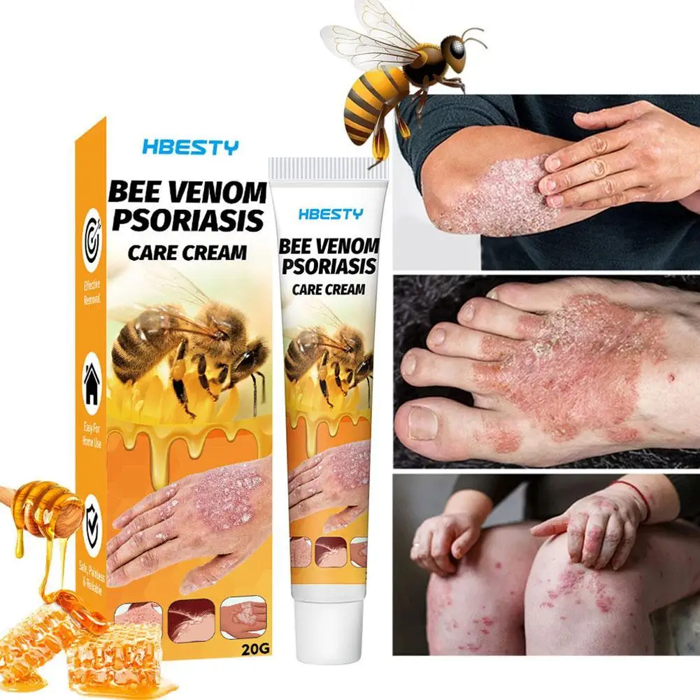 20g Psoriasiss Lotion Bee Venoms Balm Relief Cream Sunburn Relief Gel Moisturizes Skin Care Natural Instant Itch Relief Body
20g Psoriasiss Lotion Bee Venoms Balm Relief Cream Sunburn Relief Gel Moisturizes Skin Care Natural Instant Itch Relief Body