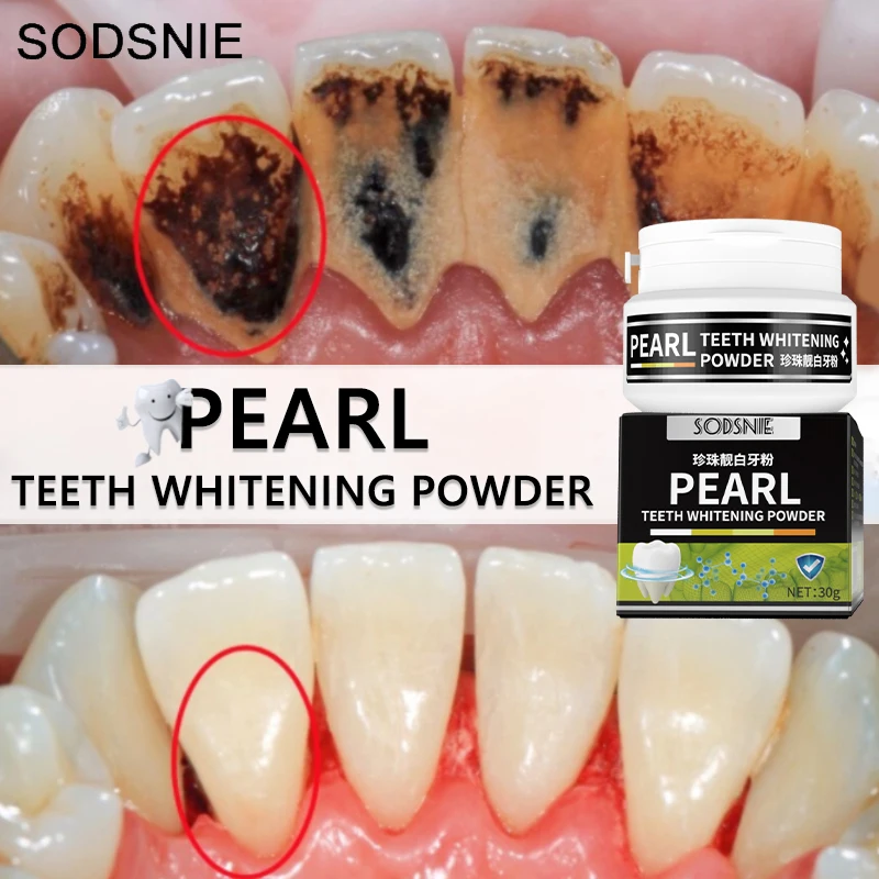 Pearl Teeth Whitening Powder Anti-Sensitive Removal Macular Smoke Stains Dirt Brighten Clean Mouth Fresh Breath Teeth Care 30g
Pearl Teeth Whitening Powder Anti-Sensitive Removal Macular Smoke Stains Dirt Brighten Clean Mouth Fresh Breath Teeth Care 30g