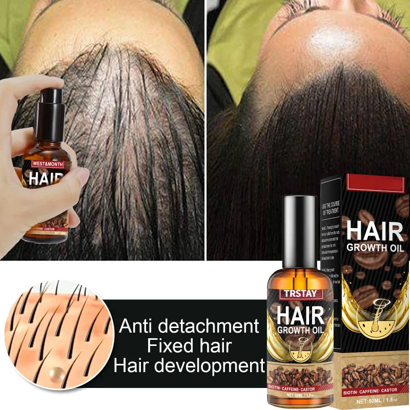 Выпадение волос головка Уход за волосами инструмент для роста кофеин длинные волосы густые волосы сильный ремонт волос поврежденные волос...
Выпадение волос головка Уход за волосами инструмент для роста кофеин длинные волосы густые волосы сильный ремонт волос поврежденные волос...