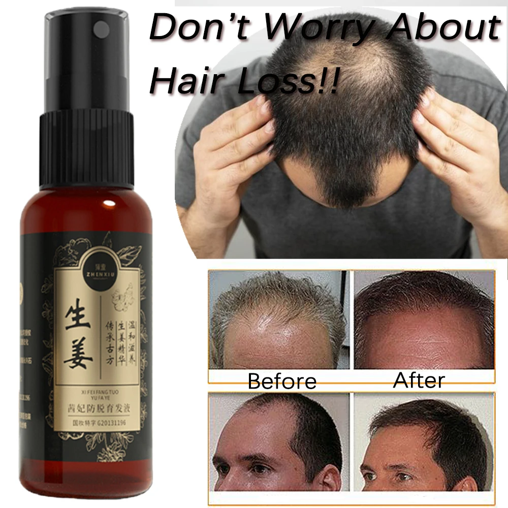 30ml Natural Anti Hair Loss Ginger Essence Hair Growth Spary Serum Oil Promote Thick Stronger Hair Scalp Treatment for Men Women
30ml Natural Anti Hair Loss Ginger Essence Hair Growth Spary Serum Oil Promote Thick Stronger Hair Scalp Treatment for Men Women