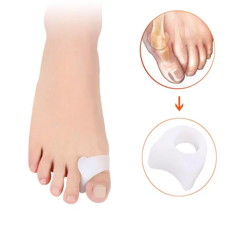 1 Pair Toe Separators Toe Silicone Bunion Guard Foot Care Orthopedic Finger Toe Separator Correction Pad Foot Care Tool
1 Pair Toe Separators Toe Silicone Bunion Guard Foot Care Orthopedic Finger Toe Separator Correction Pad Foot Care Tool