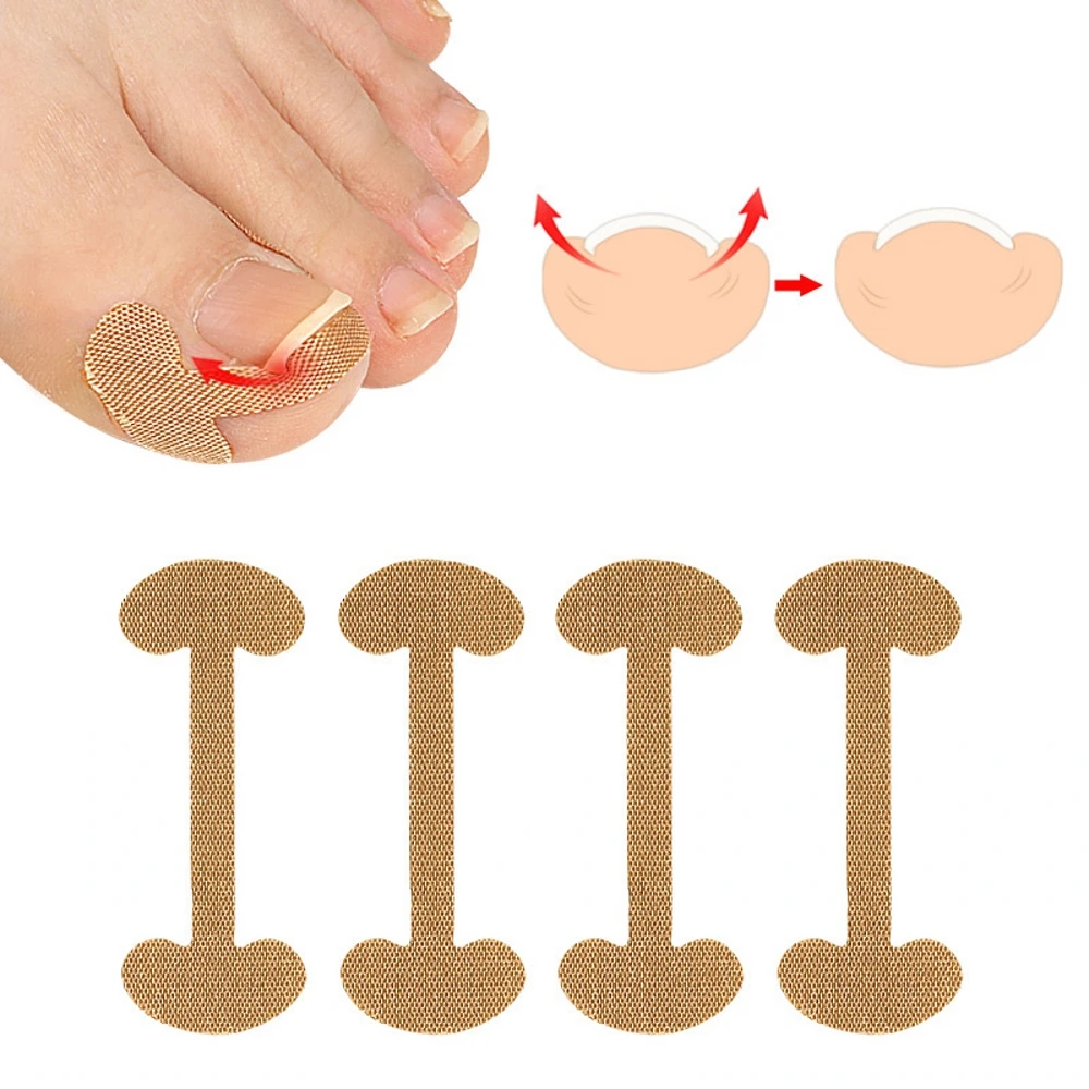 40 Stickers /10Pcs Embedded Toe Nail Corrector Sticker Toenail Care Pedicure Thumb Curl Correction Sticker
40 Stickers /10Pcs Embedded Toe Nail Corrector Sticker Toenail Care Pedicure Thumb Curl Correction Sticker