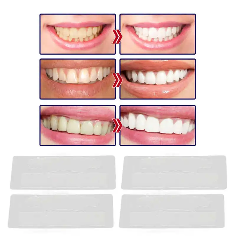 14Pcs Teeth Whitening Strips High Adhesion Stain Remover Teeth Whitening Strips for Oral Care Products
14Pcs Teeth Whitening Strips High Adhesion Stain Remover Teeth Whitening Strips for Oral Care Products