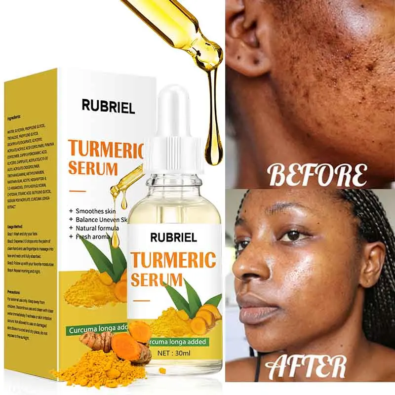 Turmeric Serum Whitening Remove Dark Spots Corrector Skin Color Dark Patches Acne Anti Wrinkle Whitening Moisturizing Skin Care
Turmeric Serum Whitening Remove Dark Spots Corrector Skin Color Dark Patches Acne Anti Wrinkle Whitening Moisturizing Skin Care