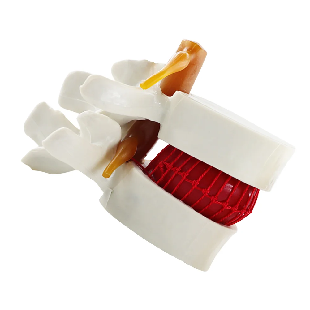 Intervertebral Disc Model Lumbar Spine Learning Mannequin Herniation Teaching Pvc Anatomical Human Body
Intervertebral Disc Model Lumbar Spine Learning Mannequin Herniation Teaching Pvc Anatomical Human Body