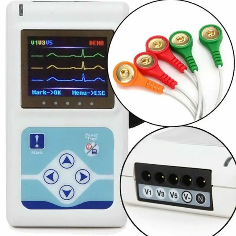 CONTEC TLC9803 динамический 3-канальный 24-часовой ЭКГ система Holter ЭКГ/ЭКГ монитор ЭКГ регистратор/анализатор ЭКГ
CONTEC TLC9803 динамический 3-канальный 24-часовой ЭКГ система Holter ЭКГ/ЭКГ монитор ЭКГ регистратор/анализатор ЭКГ