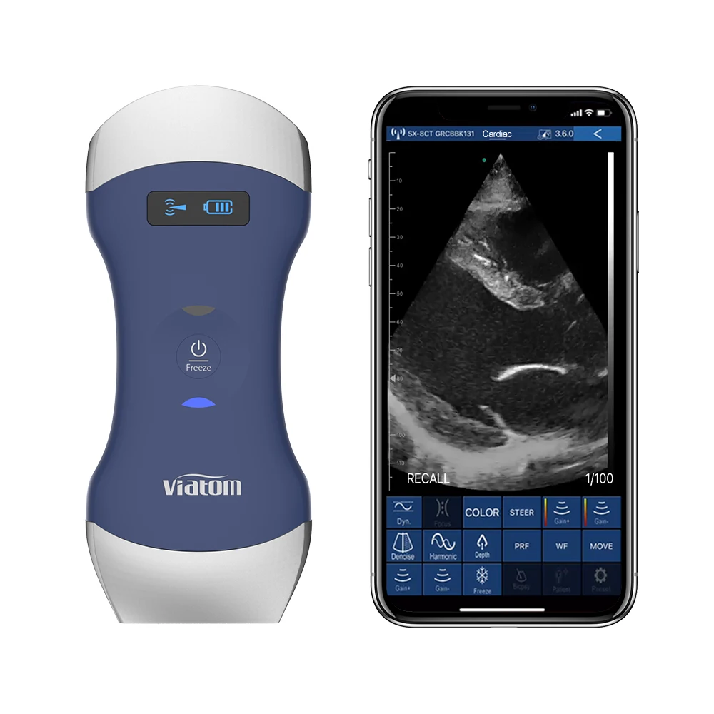 Viatom Wifi Probe Cardiac Sonoscape Physiotherapy Scanning Machine Portable Ultrasound
Viatom Wifi Probe Cardiac Sonoscape Physiotherapy Scanning Machine Portable Ultrasound