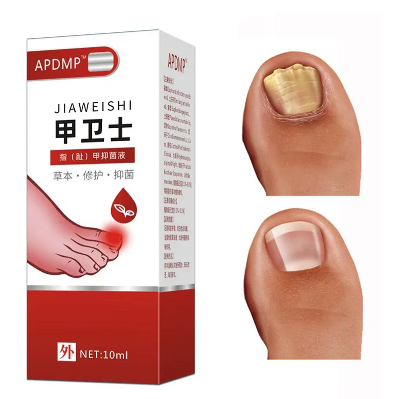 Nail Care Essential Oil Nail Thickening Repair Hair Yellow Endogenous Nail Embedding Grey Nail Brightening Nail Repair Essence
Nail Care Essential Oil Nail Thickening Repair Hair Yellow Endogenous Nail Embedding Grey Nail Brightening Nail Repair Essence