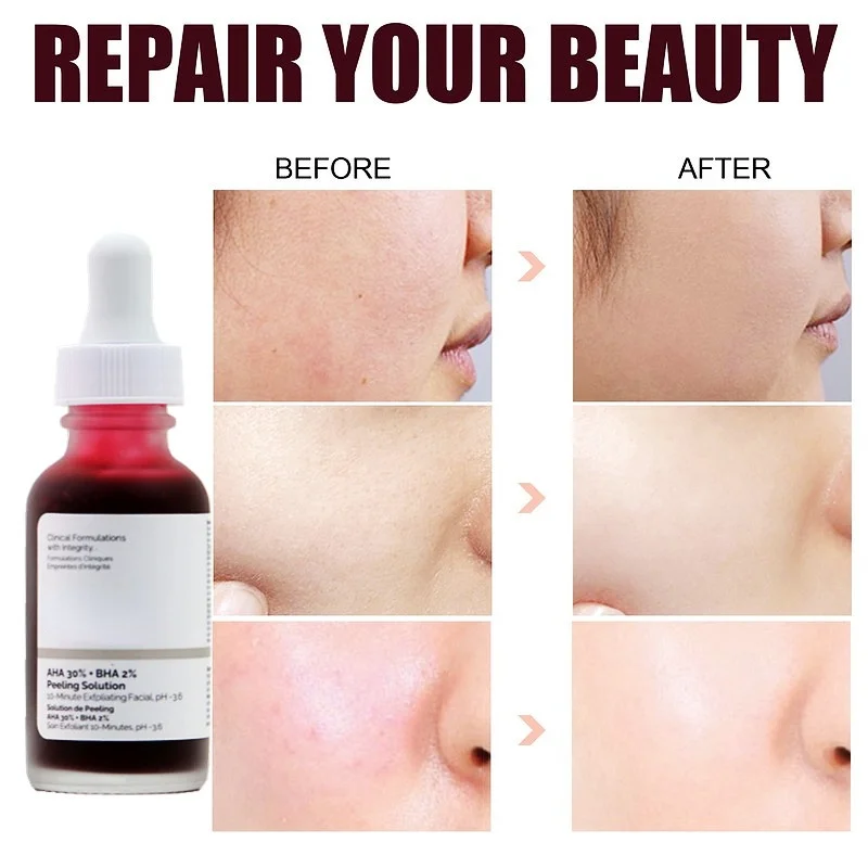 Skin Care Products Peeling Solution Primer Makeup 10-Minute Exfoliating Face Brighten Anti Aging Serum Face Skin Care Serum
Skin Care Products Peeling Solution Primer Makeup 10-Minute Exfoliating Face Brighten Anti Aging Serum Face Skin Care Serum