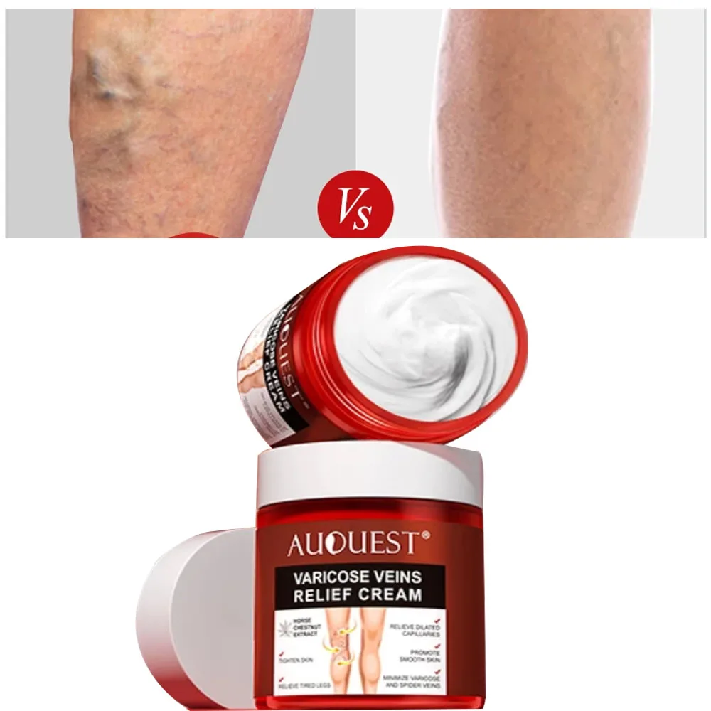Varicose Veins Relief Cream For Legs Leg Foot Varicoses Varicosities Vasculitis Phlebitis Spider Pain Relief Ointment 80g
Varicose Veins Relief Cream For Legs Leg Foot Varicoses Varicosities Vasculitis Phlebitis Spider Pain Relief Ointment 80g