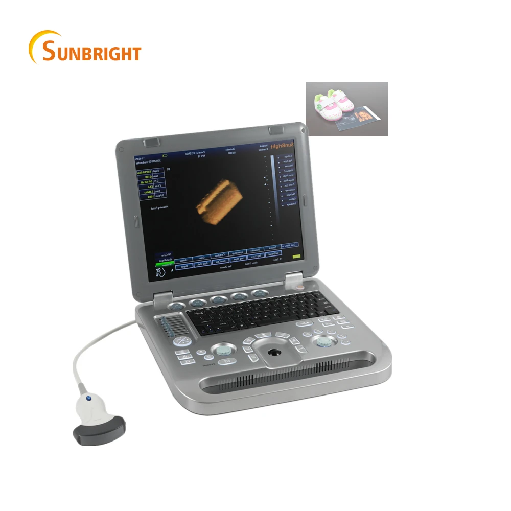 Cheap Portable Laptop Digital 3d Echography Ultrasound Apparatus Medical Instrument
Cheap Portable Laptop Digital 3d Echography Ultrasound Apparatus Medical Instrument