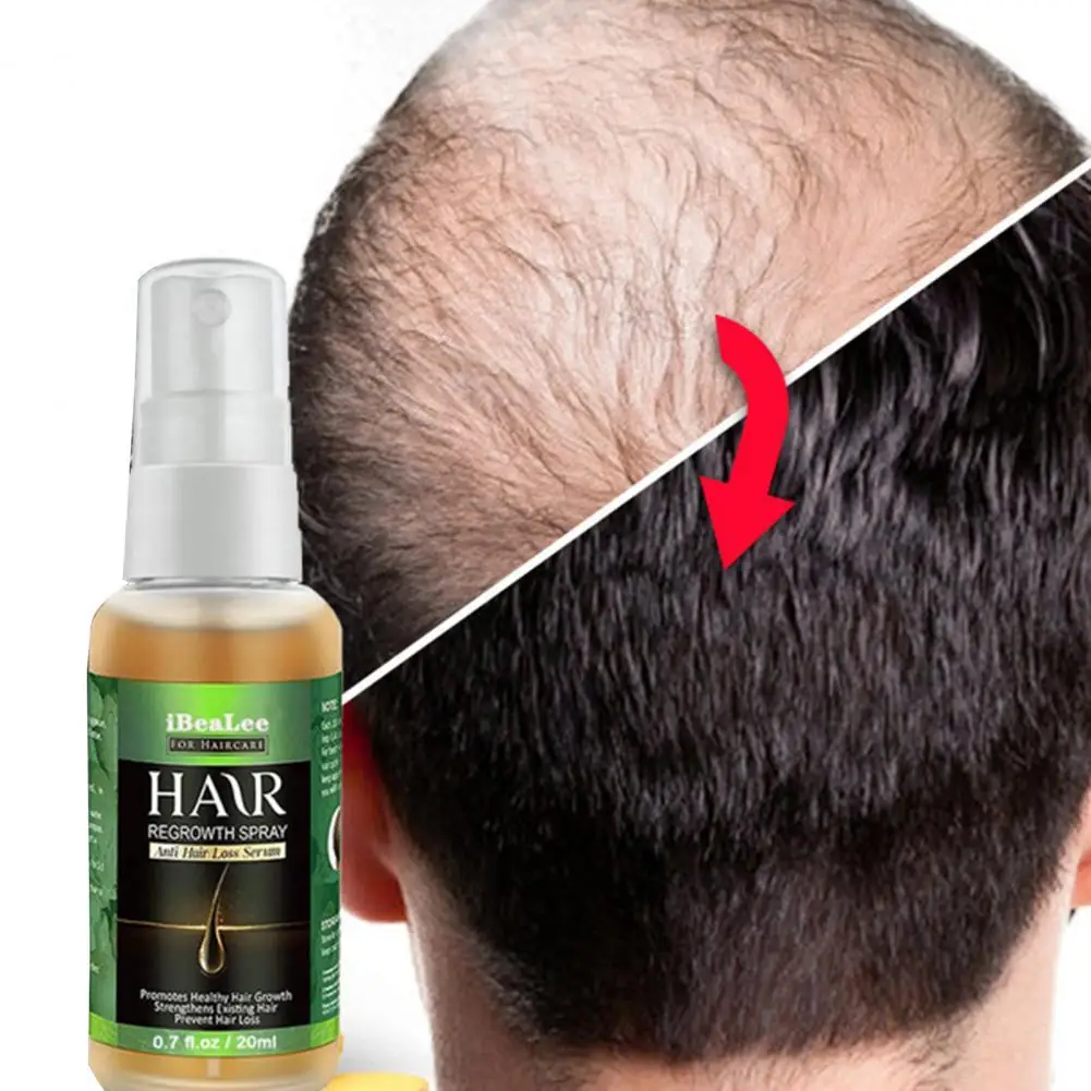 20ml Hair Oil Fast Growth Nourish Scalp Hair Care Dense Hair Growth Serum for Men Women Hair Care
20ml Hair Oil Fast Growth Nourish Scalp Hair Care Dense Hair Growth Serum for Men Women Hair Care