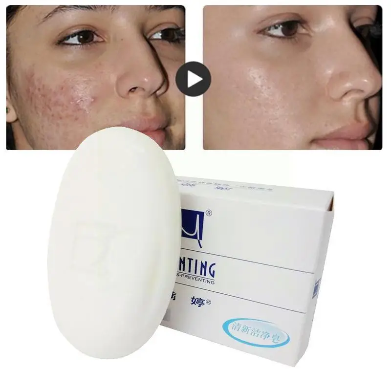 MANTING Mites Acarus Acari Removing Body Face Skin Handmade New Fresh Acne Soap Oil Clean Care Herbal Soap Control Soap M7K4
MANTING Mites Acarus Acari Removing Body Face Skin Handmade New Fresh Acne Soap Oil Clean Care Herbal Soap Control Soap M7K4
