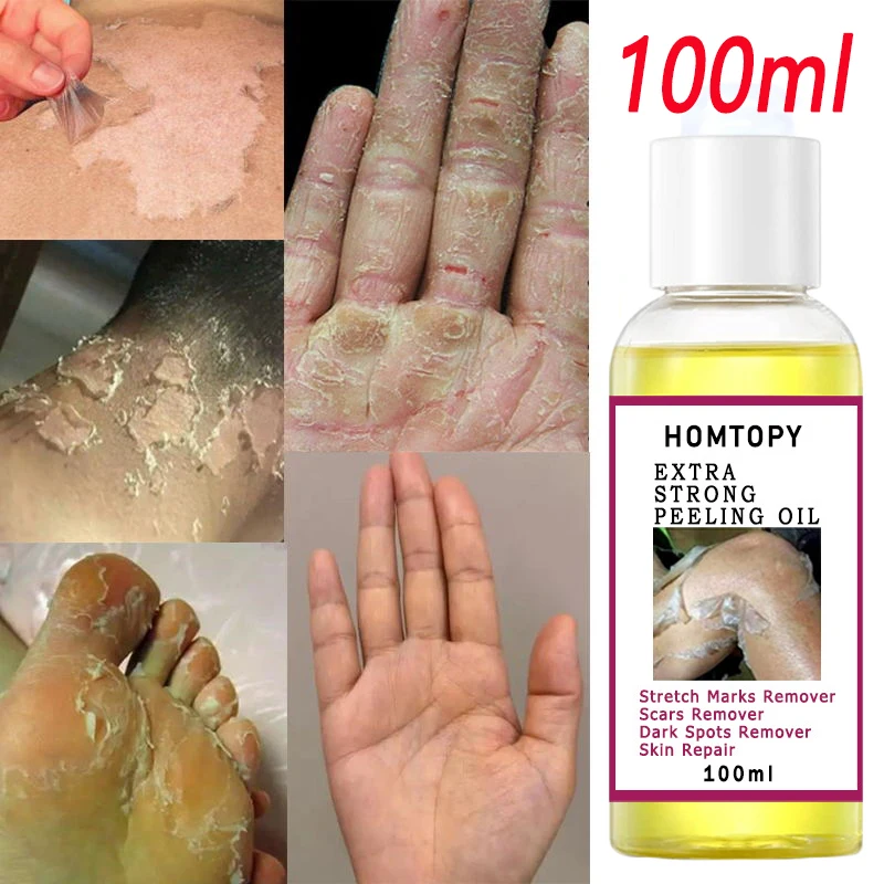 Yellow Peeling Oil Dark Skin Bleaching Remove Arm Knee Legs Melanin Exfoliating Dead Skin Whiten Moisturize Body Skin Care Serum
Yellow Peeling Oil Dark Skin Bleaching Remove Arm Knee Legs Melanin Exfoliating Dead Skin Whiten Moisturize Body Skin Care Serum