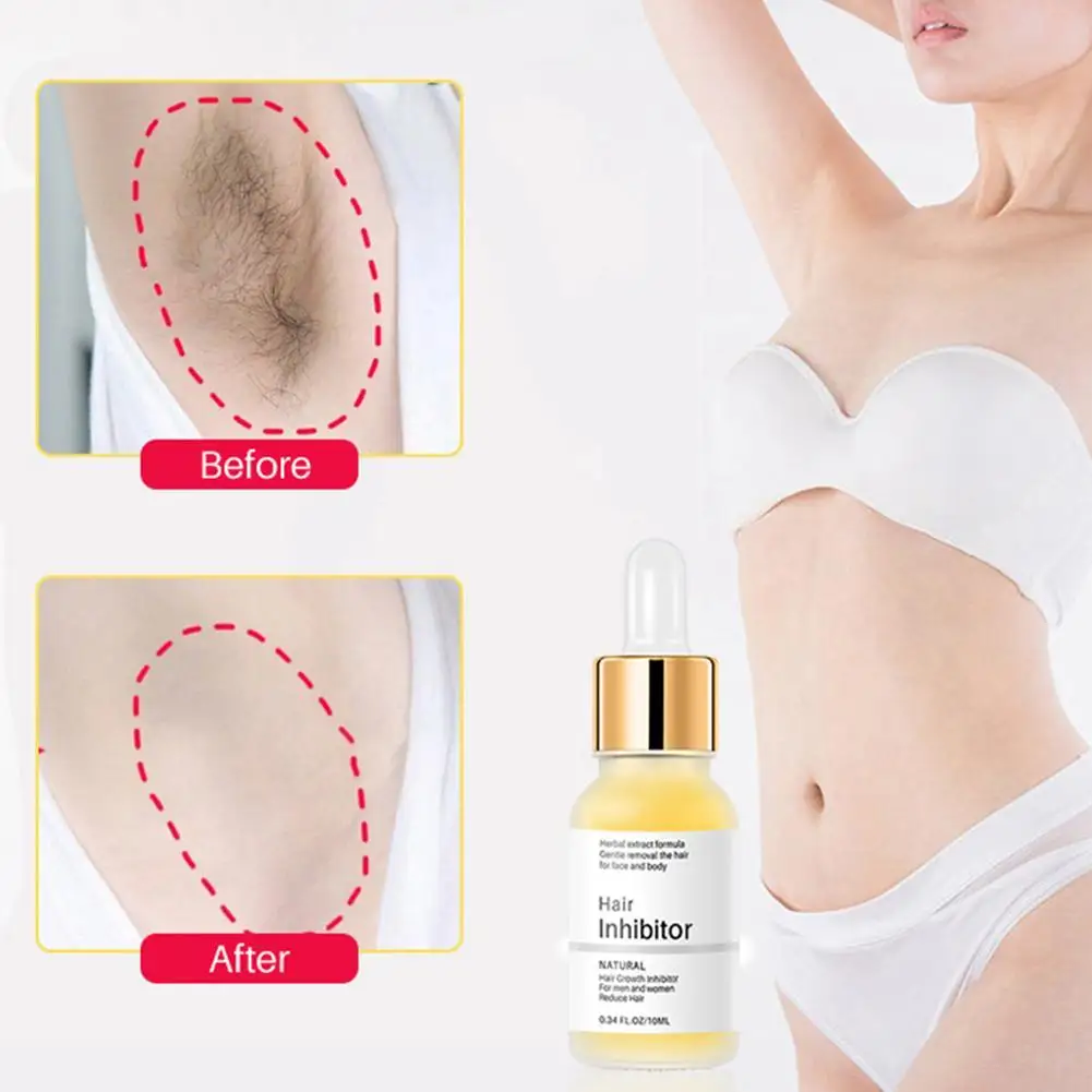 Hair Remover Care Hair Inhibition Serum For Men And Women Growth Inhibitor Facial Removal Serum Gentle Fast Easy Remover
Hair Remover Care Hair Inhibition Serum For Men And Women Growth Inhibitor Facial Removal Serum Gentle Fast Easy Remover