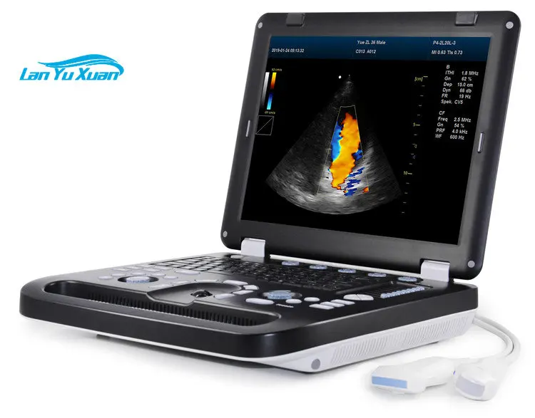 BT-UD63 Hospital portable human 3d 4d 5d ultrasound machine price ultra sound scanner maternity ultrasound scan machine
BT-UD63 Hospital portable human 3d 4d 5d ultrasound machine price ultra sound scanner maternity ultrasound scan machine
