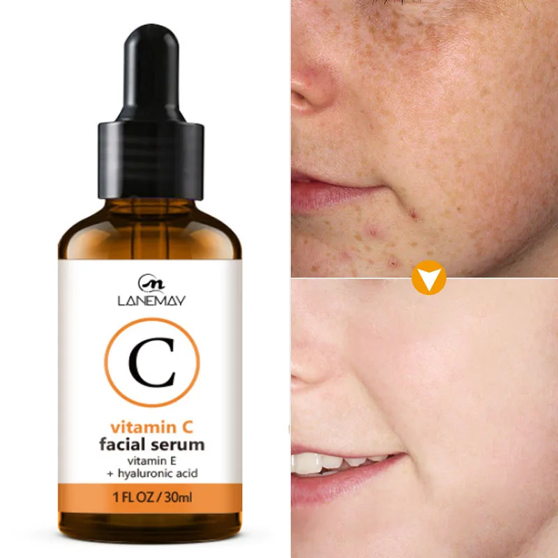 Vitamin C Whitening Face Serum Remove Pigmentation Shrink Pores Brighten Smooth Essence Hyaluronic Acid Moisturizing Skin Care
Vitamin C Whitening Face Serum Remove Pigmentation Shrink Pores Brighten Smooth Essence Hyaluronic Acid Moisturizing Skin Care