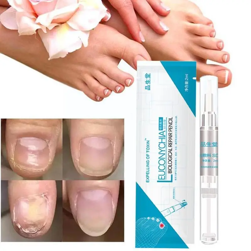 Nail Repair Liquid Pen Fungus Treatment Anti Fungal Repair Onychomycosis Pencil Rehydration Nutrient Solution Biological Re A9j1
Nail Repair Liquid Pen Fungus Treatment Anti Fungal Repair Onychomycosis Pencil Rehydration Nutrient Solution Biological Re A9j1