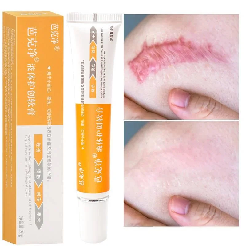 Acne Scar Removal Face Cream Acne Spots Acne Pigmentation Corrector Anti Scar Stretch Marks Repair Skin Care
Acne Scar Removal Face Cream Acne Spots Acne Pigmentation Corrector Anti Scar Stretch Marks Repair Skin Care