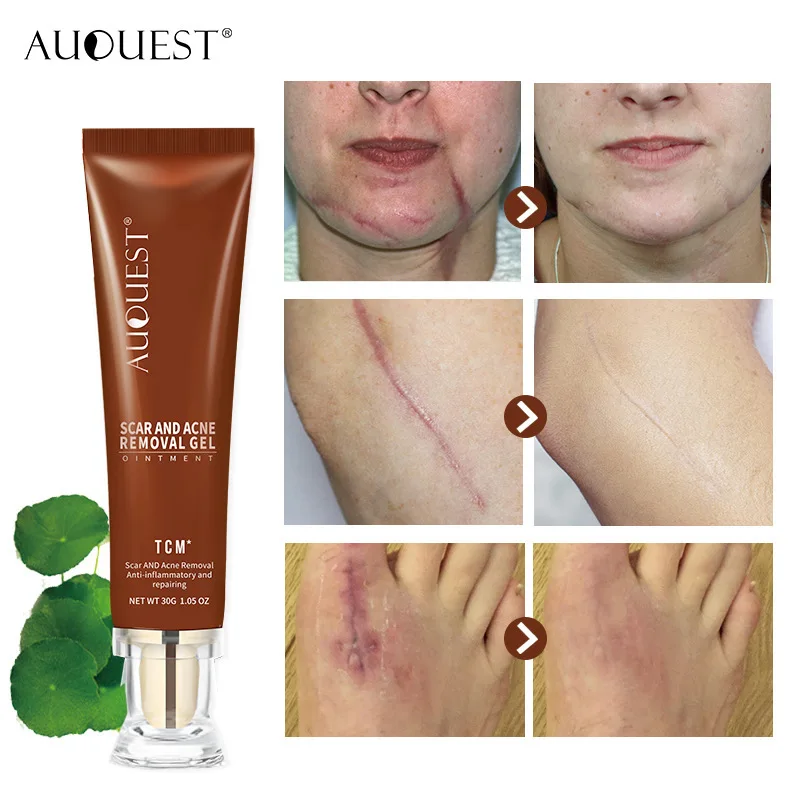 2PCS/LOT AUQUEST Scar Repair Cream Stretch Marks Acne Remove Promote Cell Regeneration Freckles Spots Removal Skin Care
2PCS/LOT AUQUEST Scar Repair Cream Stretch Marks Acne Remove Promote Cell Regeneration Freckles Spots Removal Skin Care