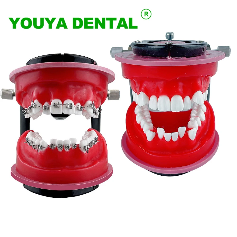 

Dental Orthodontic Teeth Model Dentistry Treatment Demonstration Typodont Model For Dentist Practice Training Study Teaching