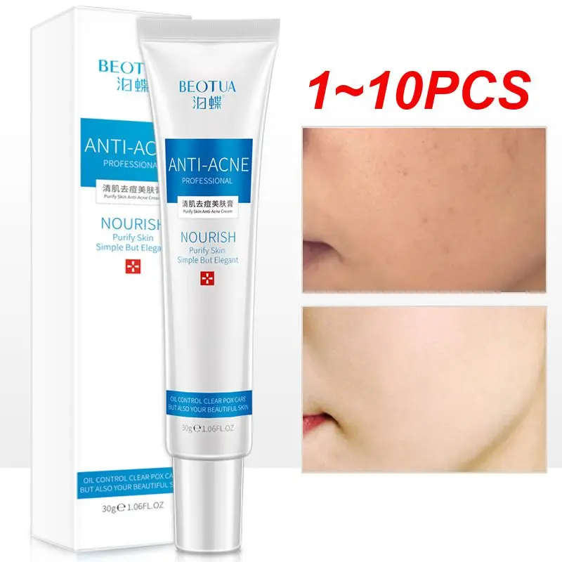 1-10 шт., увлажняющий крем от прыщей
1-10 шт., увлажняющий крем от прыщей