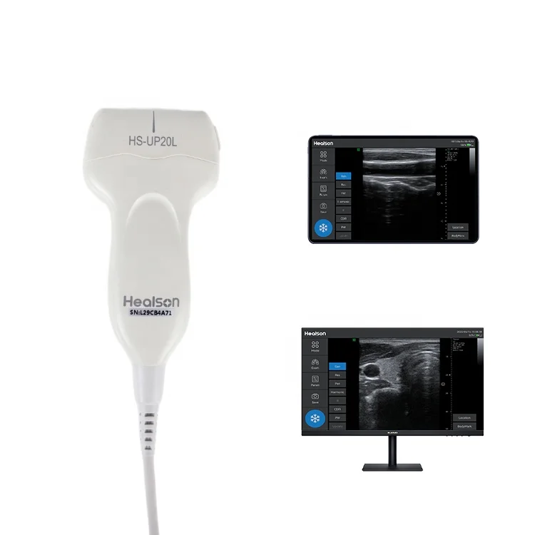 Healson Pocket Linear Doppler Handheld Digital Ultrasound Probe Portable USG Machine
Healson Pocket Linear Doppler Handheld Digital Ultrasound Probe Portable USG Machine