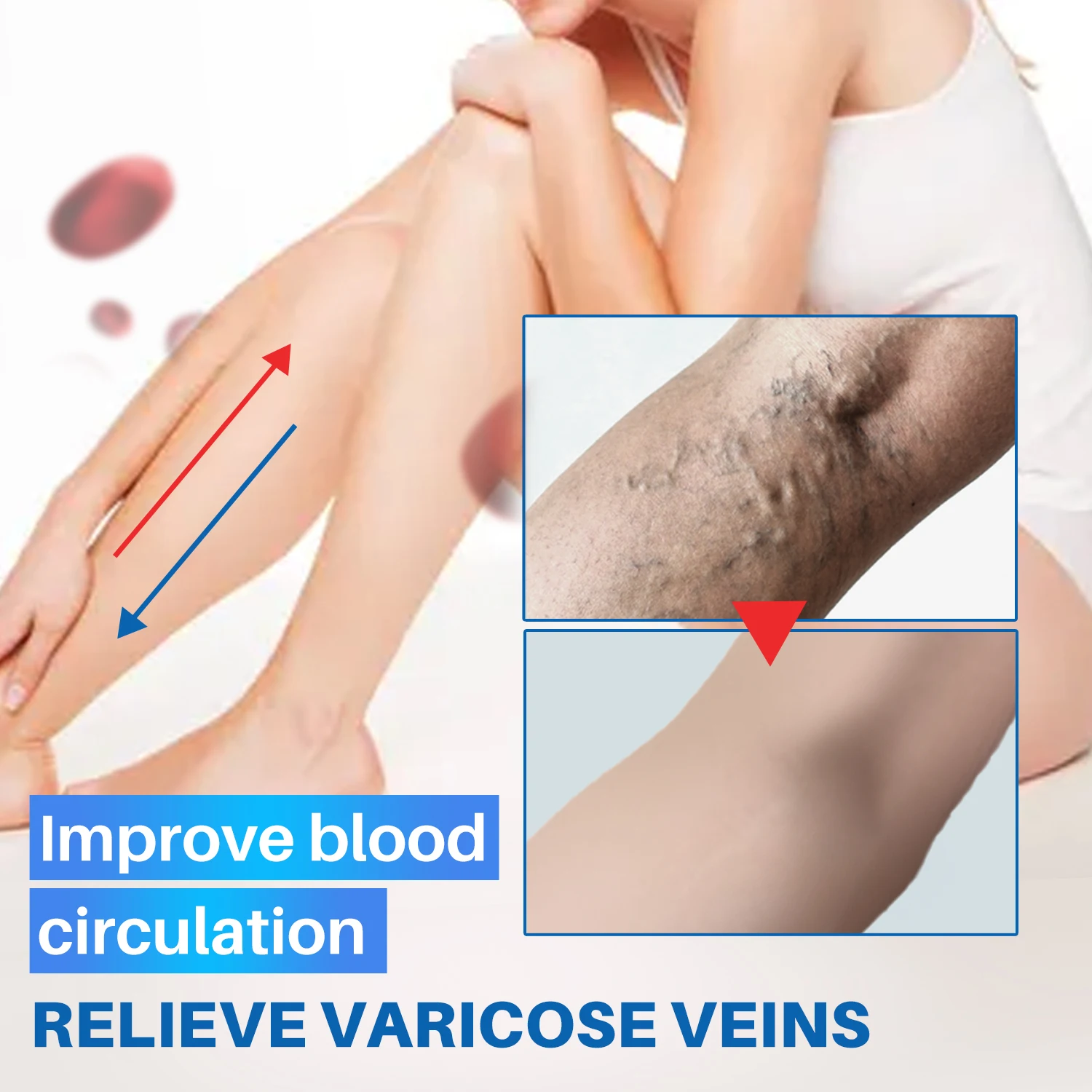 Varicose Veins Treatment Serum Liquid Relief Phlebitis Angiitis Remedy Pain Serum For Spider Veins Edema Nerve Pain Leg Pain
Varicose Veins Treatment Serum Liquid Relief Phlebitis Angiitis Remedy Pain Serum For Spider Veins Edema Nerve Pain Leg Pain