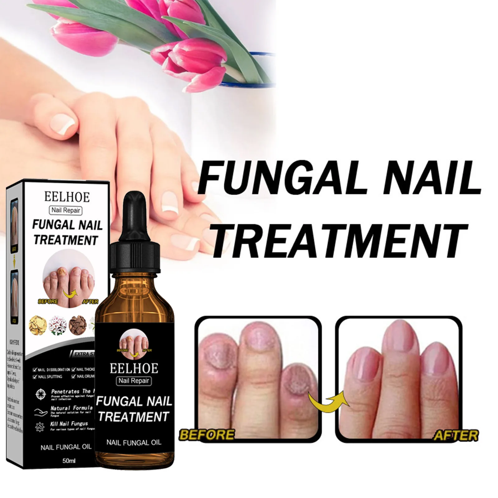 Fast Fungal Nail Treatments Serum Onychomycosis Paronychia Anti-Fungal Anti-infective Herb Toe Fungus Foot Repair Essences Care
Fast Fungal Nail Treatments Serum Onychomycosis Paronychia Anti-Fungal Anti-infective Herb Toe Fungus Foot Repair Essences Care