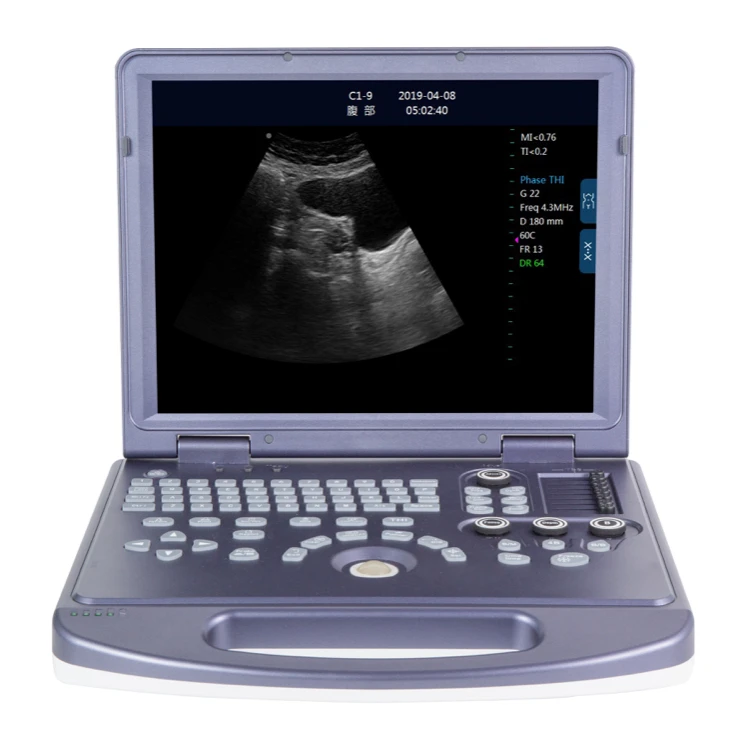 Digital Ultrasound Scanner Cheap Linear Ultrasound Scanner Bondway Ultrasound Scanner Fetal
Digital Ultrasound Scanner Cheap Linear Ultrasound Scanner Bondway Ultrasound Scanner Fetal