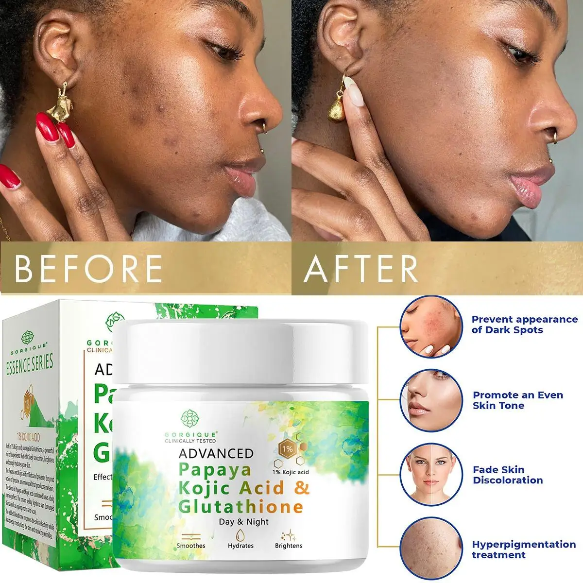 

Best Kojic Acid Cream Skin Nourishing & Resurfacing Fade Cream skin care face cream bioaqua acne creme