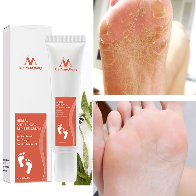 5Pcs Meiyanqiong Foot Cream Foot Anti Fungal Onychomycosis Paronychia Repair Cream Beriberi Feet Toes Foot Skin Treatment Cream
5Pcs Meiyanqiong Foot Cream Foot Anti Fungal Onychomycosis Paronychia Repair Cream Beriberi Feet Toes Foot Skin Treatment Cream