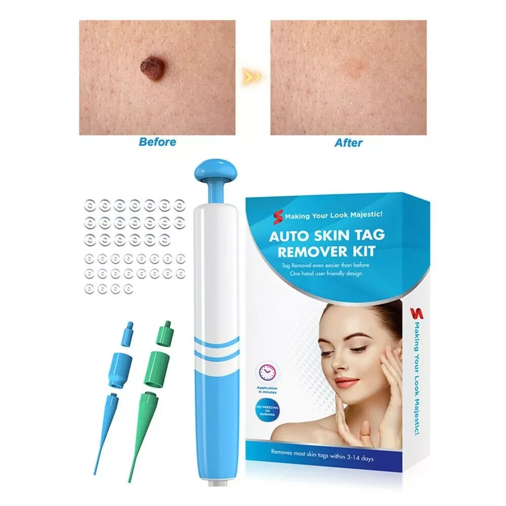 Skin Tag Remover Mole Remover Skin Tag Removal Kit Auto Tag Remover wart cauterizer Skin Tag Removal Tag Remover Corn Removal
Skin Tag Remover Mole Remover Skin Tag Removal Kit Auto Tag Remover wart cauterizer Skin Tag Removal Tag Remover Corn Removal