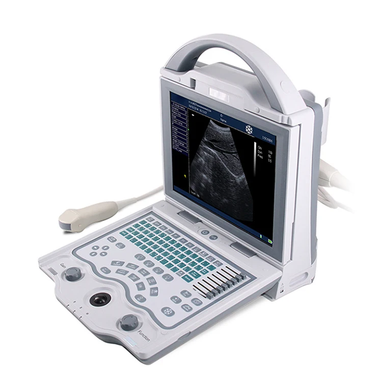 YSB5600 Hot selling B/W doppler portable ultrasound scanner with competitive price
YSB5600 Hot selling B/W doppler portable ultrasound scanner with competitive price