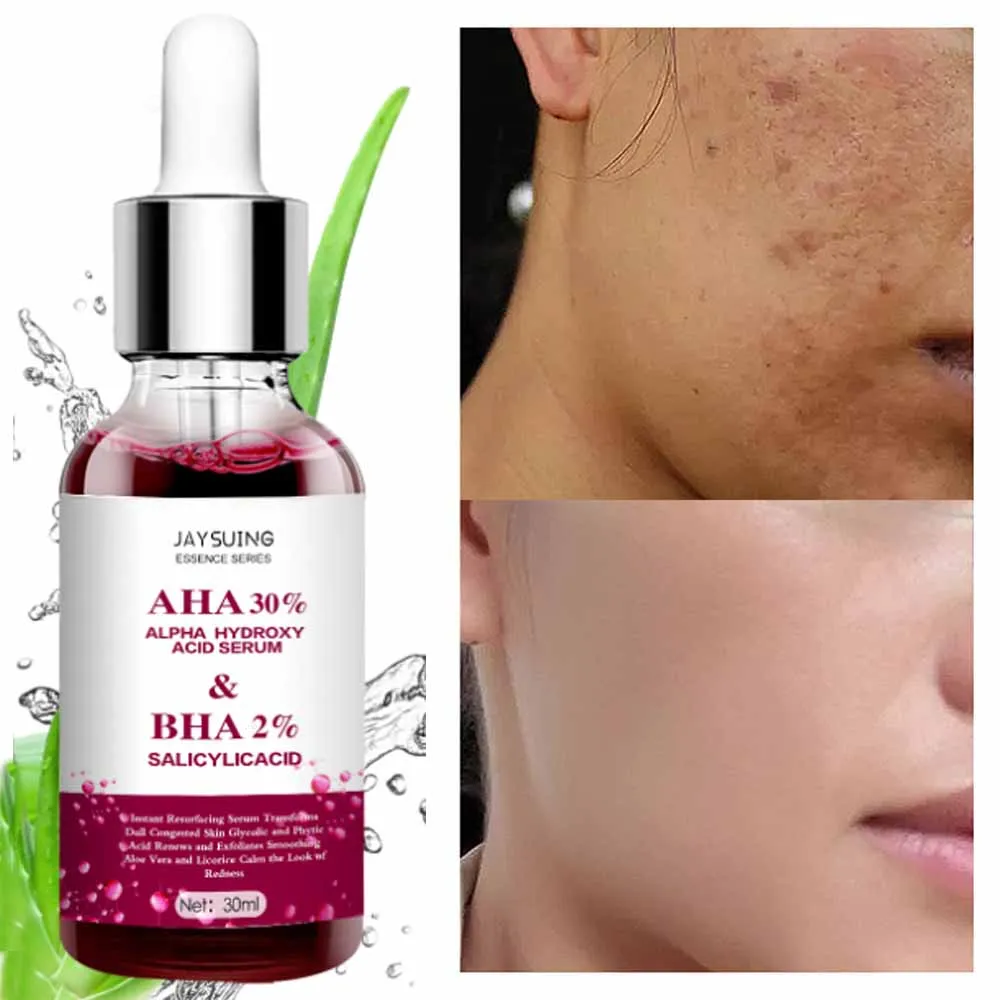 Salicylic Acid Acne Serum Shrink Pores Exfoliating Oil-Control Care Remove Blackheads Dark Yellow Moisturizing Brighten Products
Salicylic Acid Acne Serum Shrink Pores Exfoliating Oil-Control Care Remove Blackheads Dark Yellow Moisturizing Brighten Products