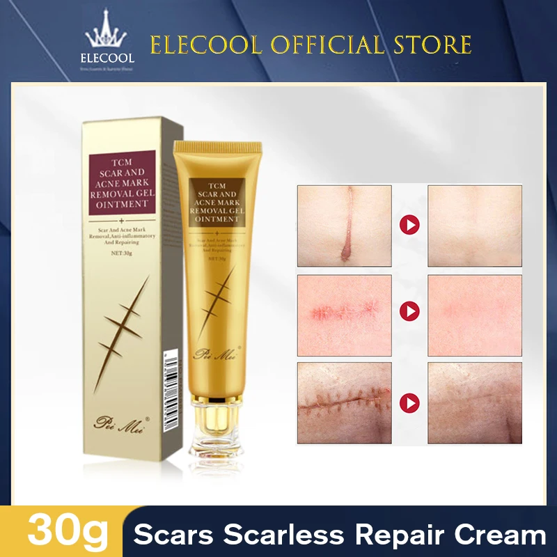 Women TCM Scar Cream Scald Stretch Mark Repair Cream Absorbed Quickly Treatments Whitening Cream Skin Repair Face Cream TSLM1
Women TCM Scar Cream Scald Stretch Mark Repair Cream Absorbed Quickly Treatments Whitening Cream Skin Repair Face Cream TSLM1