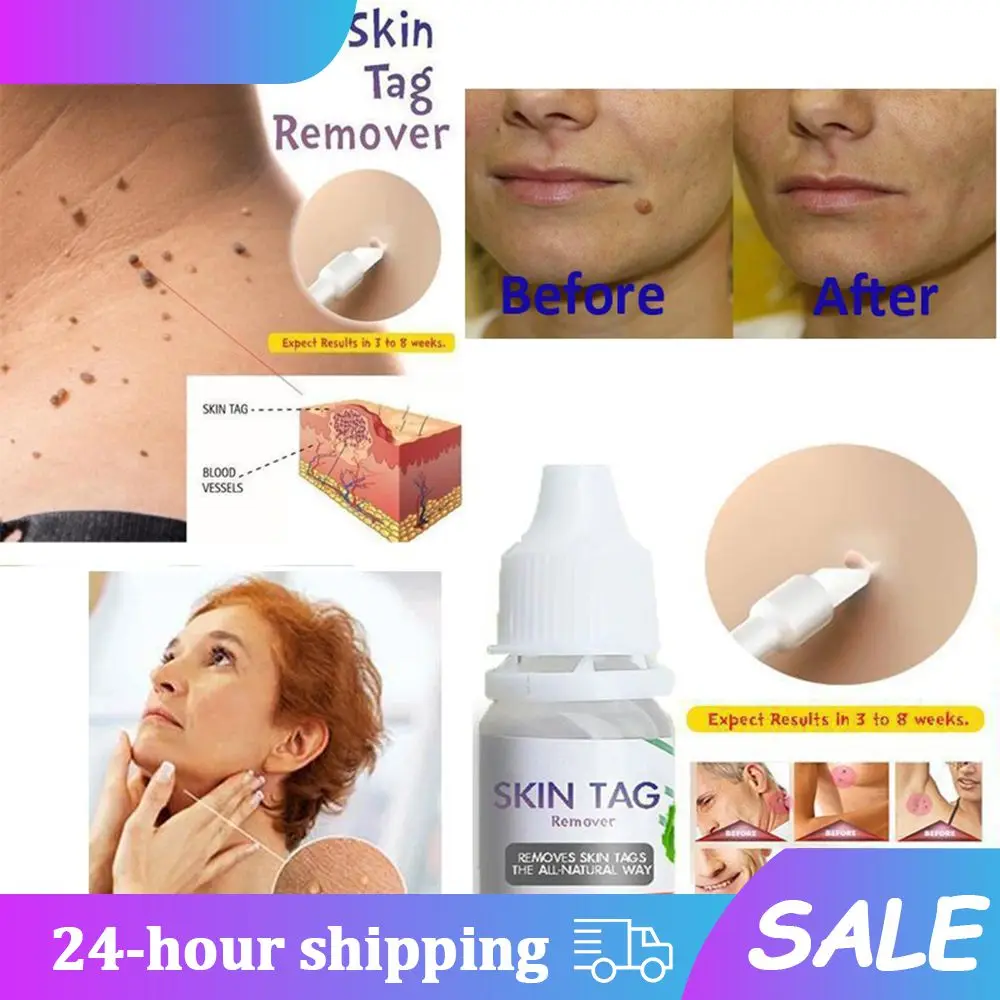 10mL Skin Tag Remover Foot Corn Blackhead Remover Warts Treat Papillomas Remover Liquid Skin Care Repair Black Spot Face Care
10mL Skin Tag Remover Foot Corn Blackhead Remover Warts Treat Papillomas Remover Liquid Skin Care Repair Black Spot Face Care