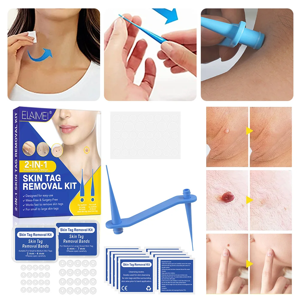 Skin Tag Removal Kit Painless Safe Mole Wart Remover Device Micro Skin Tag Removal Tool For Small To Large Size Skin Care Tool
Skin Tag Removal Kit Painless Safe Mole Wart Remover Device Micro Skin Tag Removal Tool For Small To Large Size Skin Care Tool