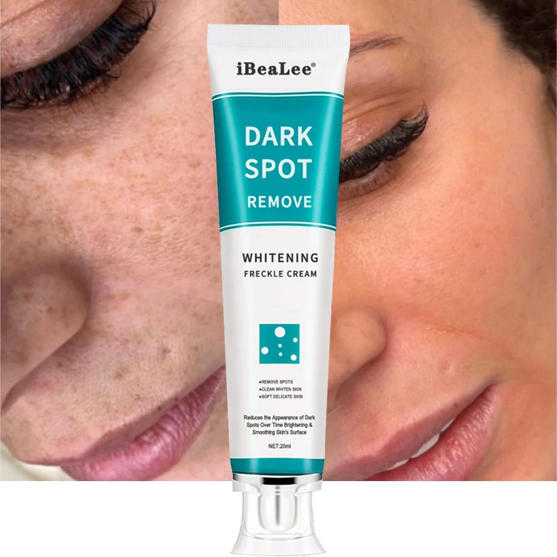 20ml Moisturizing Whitening Freckle Cream Remove Acne Dark Spots Fade Melanin Melasma Anti Freckle Brighten Face Skin Care
20ml Moisturizing Whitening Freckle Cream Remove Acne Dark Spots Fade Melanin Melasma Anti Freckle Brighten Face Skin Care