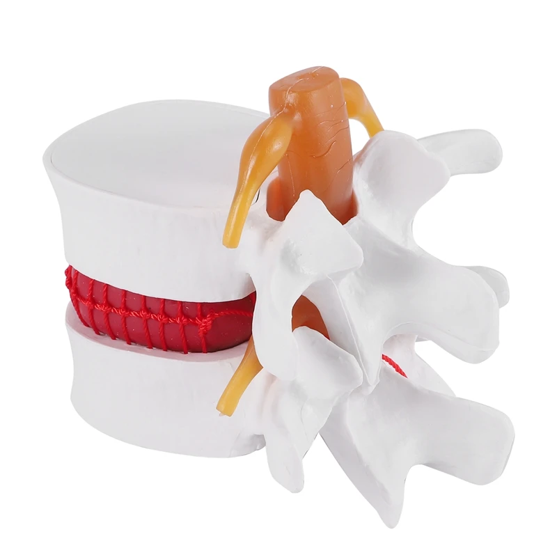 1:1.5 Human Lumbar Disc Herniation Demonstration Model Of Lumbar Vertebral Spine Model For Human Anatomy
1:1.5 Human Lumbar Disc Herniation Demonstration Model Of Lumbar Vertebral Spine Model For Human Anatomy