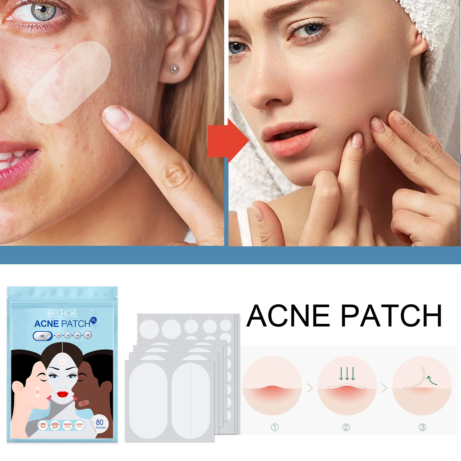 Invisible Acne Absorbing Cover Patch Hydrocolloid Acne Pimple Patch Skin Care For Women Girls Acne Pimple Absorbing Cover EIG88
Invisible Acne Absorbing Cover Patch Hydrocolloid Acne Pimple Patch Skin Care For Women Girls Acne Pimple Absorbing Cover EIG88