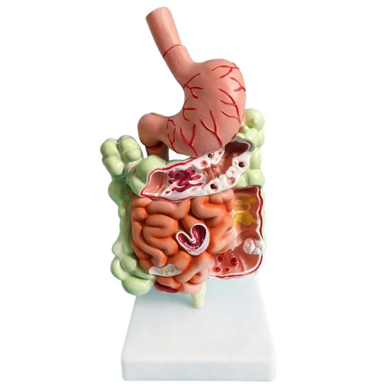 Human Digestive System Model Stomach Anatomy Large Intestine Cecum Rectum Duodenum Human Internal Organs Structure Model
Human Digestive System Model Stomach Anatomy Large Intestine Cecum Rectum Duodenum Human Internal Organs Structure Model