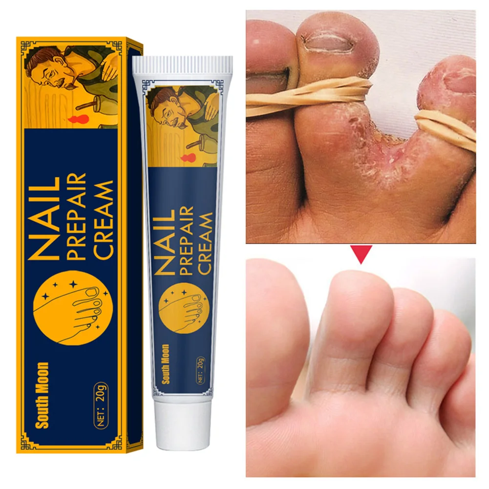 Antibacterial Cream Psoriasis Cream Herbal Treatment Eczema Anti-itch Relief Rash Urticaria Desquamation Ointment Body Skin Care
Antibacterial Cream Psoriasis Cream Herbal Treatment Eczema Anti-itch Relief Rash Urticaria Desquamation Ointment Body Skin Care