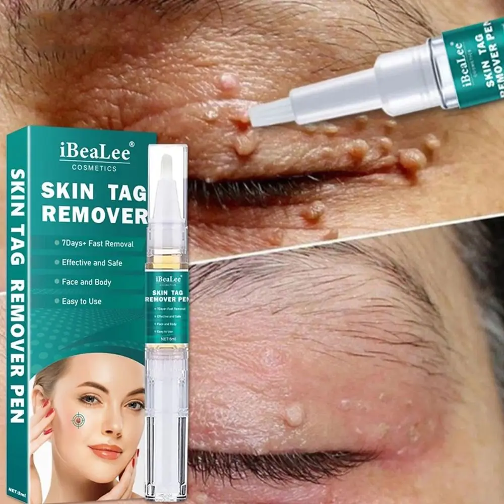 5ml Treatment Removal Removal Cream Essential Oil Painless Skin Tags Remover Warts Remover Skin Dark Spot
5ml Treatment Removal Removal Cream Essential Oil Painless Skin Tags Remover Warts Remover Skin Dark Spot