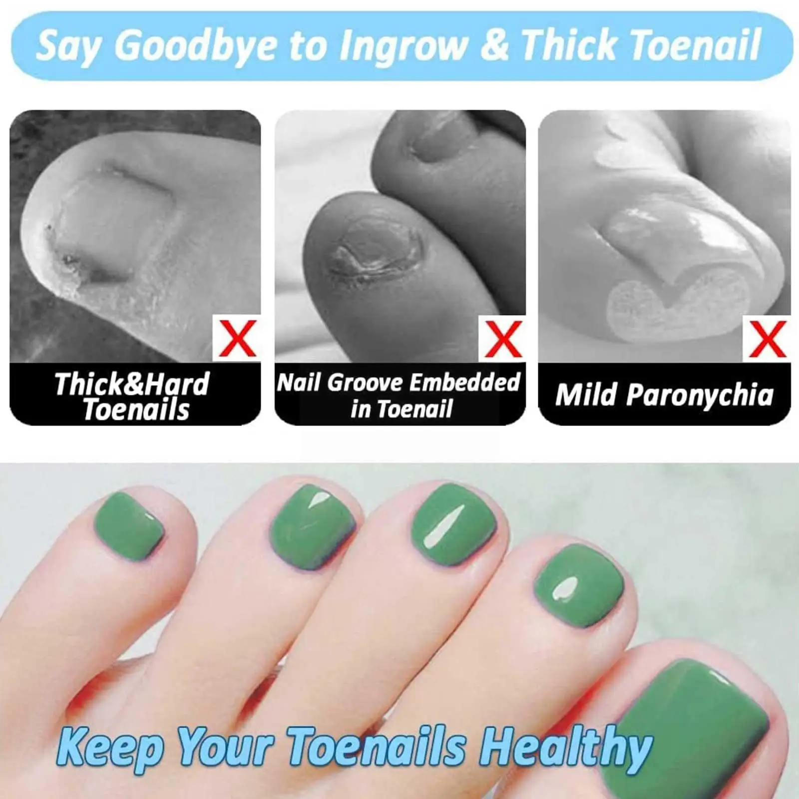 Toe Nail Clippers Nail Correction Dead Skin Dirt Remover Ingrown Pedicure Thick Care Correction Toenail Nails Tool Paronych D5Q4
Toe Nail Clippers Nail Correction Dead Skin Dirt Remover Ingrown Pedicure Thick Care Correction Toenail Nails Tool Paronych D5Q4