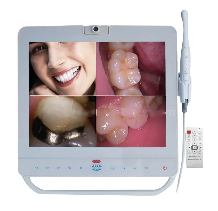 Стоматологическая внутриротовая камера высокого разрешения Denspay с 15-дюймовым монитором
Стоматологическая внутриротовая камера высокого разрешения Denspay с 15-дюймовым монитором