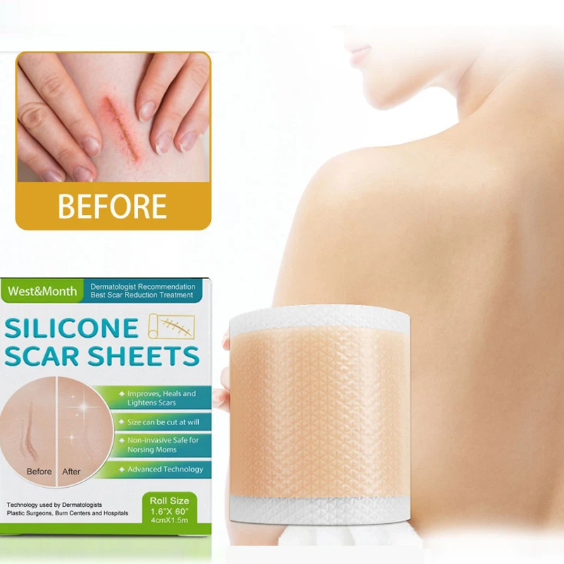 Silicone scar sheets dilute orange peel growth lines removal surgery stretch marks patch smooth skin repair care beauty sticker
Silicone scar sheets dilute orange peel growth lines removal surgery stretch marks patch smooth skin repair care beauty sticker