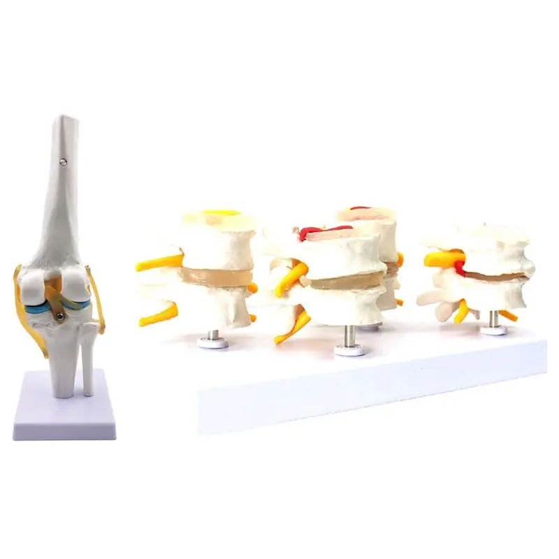 Knee Joint Simulation Model With Human Anatomy Skeleton Spine 4-Stages Lumbar Vertebral Model Brain Skull
Knee Joint Simulation Model With Human Anatomy Skeleton Spine 4-Stages Lumbar Vertebral Model Brain Skull